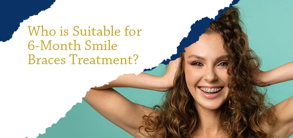 Who is Suitable for 6-Month Smile Braces Treatment?